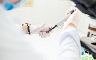 Hantavirus: Prenos među ljudima redak, ali moguć kod pojedinih sojeva: Simptomi - temperatura, malaksalost i bol u mišićima