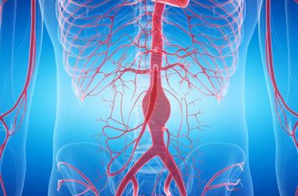 Aneurizme trbušne aorte: Uzroci, simptomi i lečenje