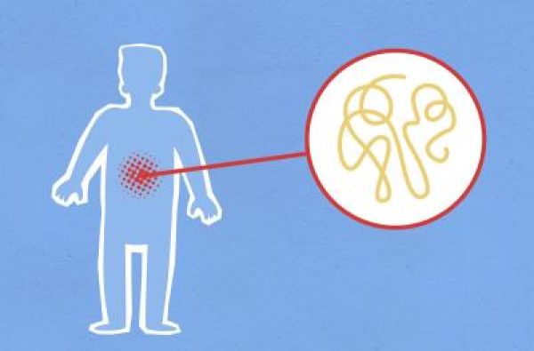 Stomačni virus kod dece: Kako pravilno reagovati i sprečiti dehidraciju