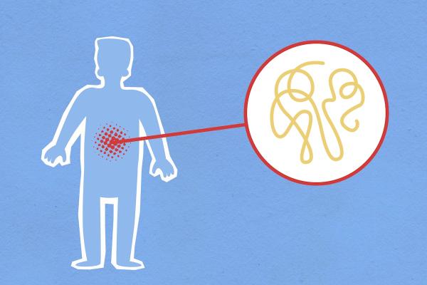 Stomačni virus kod dece: Kako pravilno reagovati i sprečiti dehidraciju