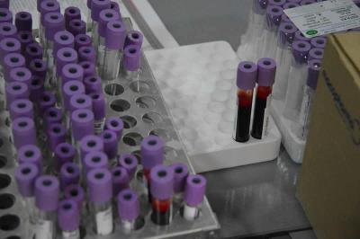 U utorak u Apatinu nova akcija dobrovoljnog davanja krvi