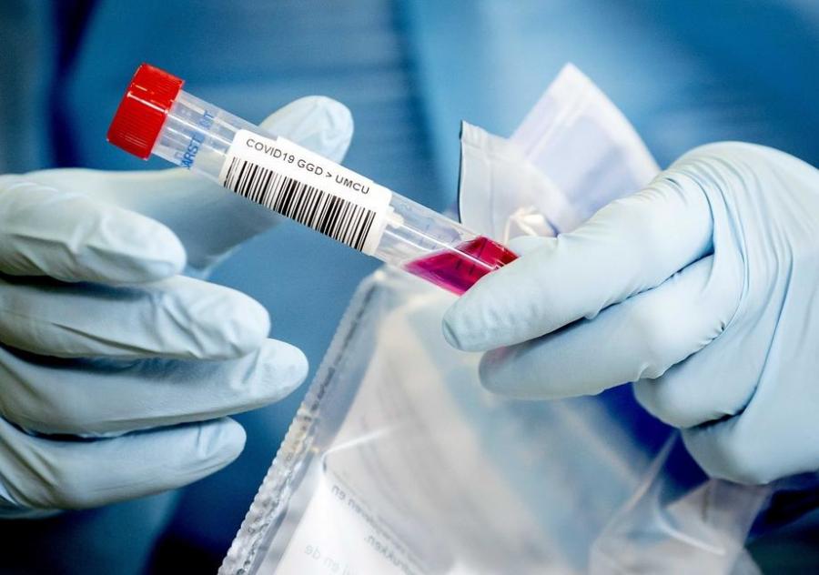 34 medicinska radnika obolelo od koronavirusa u somborskoj bolnici