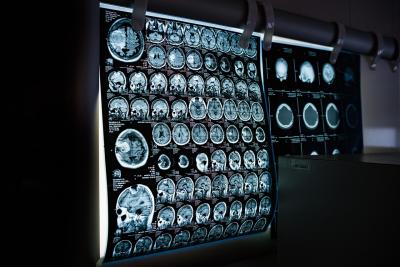 Neurolog otkriva da JEDNA NAVIKA može da održi mozak mladim decenijama