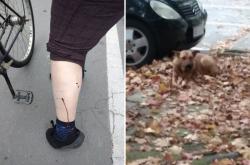 Novi napadi psasa u Apatinu: Pas napao ženu na biciklu i ujeo je za nogu
