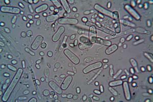 Nova istraživanja otkrivaju vezu između crevnih bakterija i nesanice